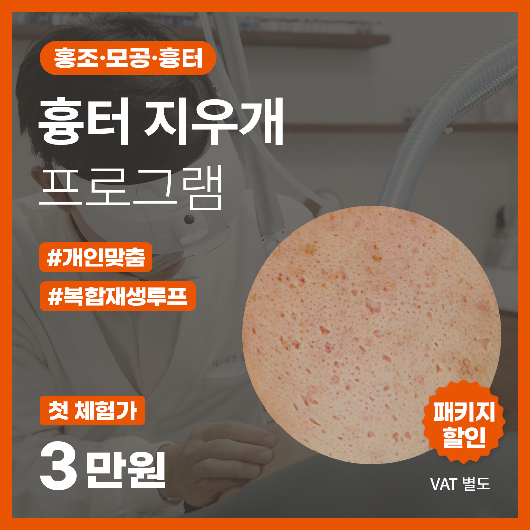 이벤트 02